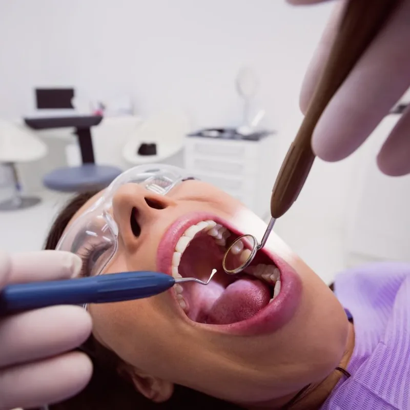 Example to avoid: clinical close-up of an open mouth during treatment